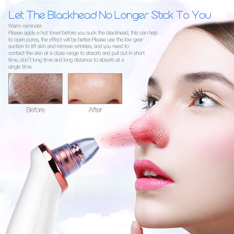 Vacuum Blackhead Remover Pro – Deep Pore Acne & Pimple Suction Cleaner