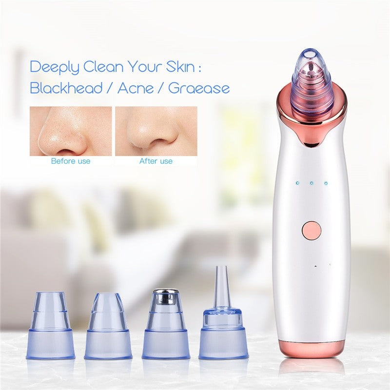 Vacuum Blackhead Remover Pro – Deep Pore Acne & Pimple Suction Cleaner